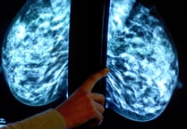 Tens of thousands of Devon women miss “vital” breast cancer screenings