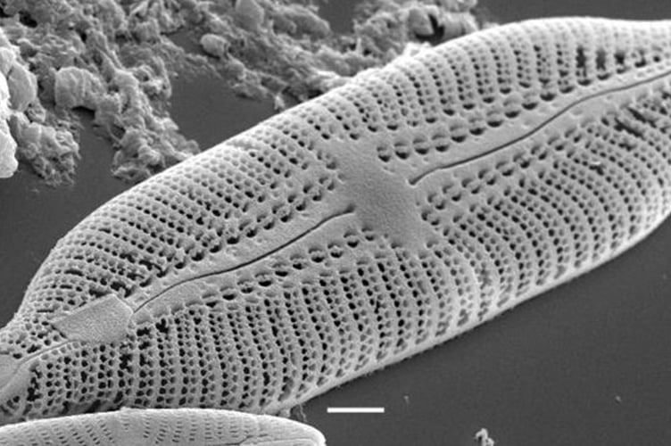 Electronmicrograph of mudflat diatom - Gatty Lab., St.Andrews University