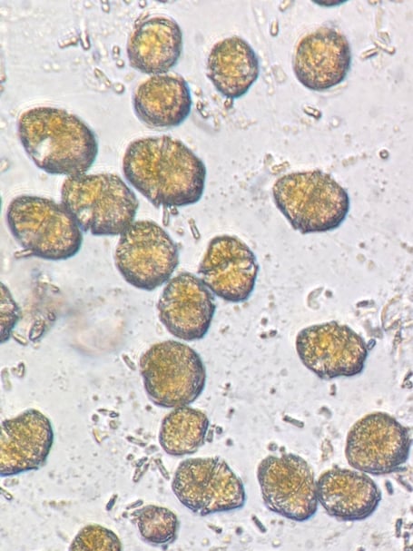Alexandrium species of dinoflagellate - Nigel Mortimer