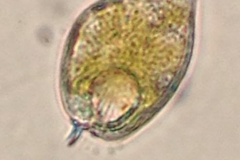 Prorocentrum micans dinoflagellate bloom of 2014
